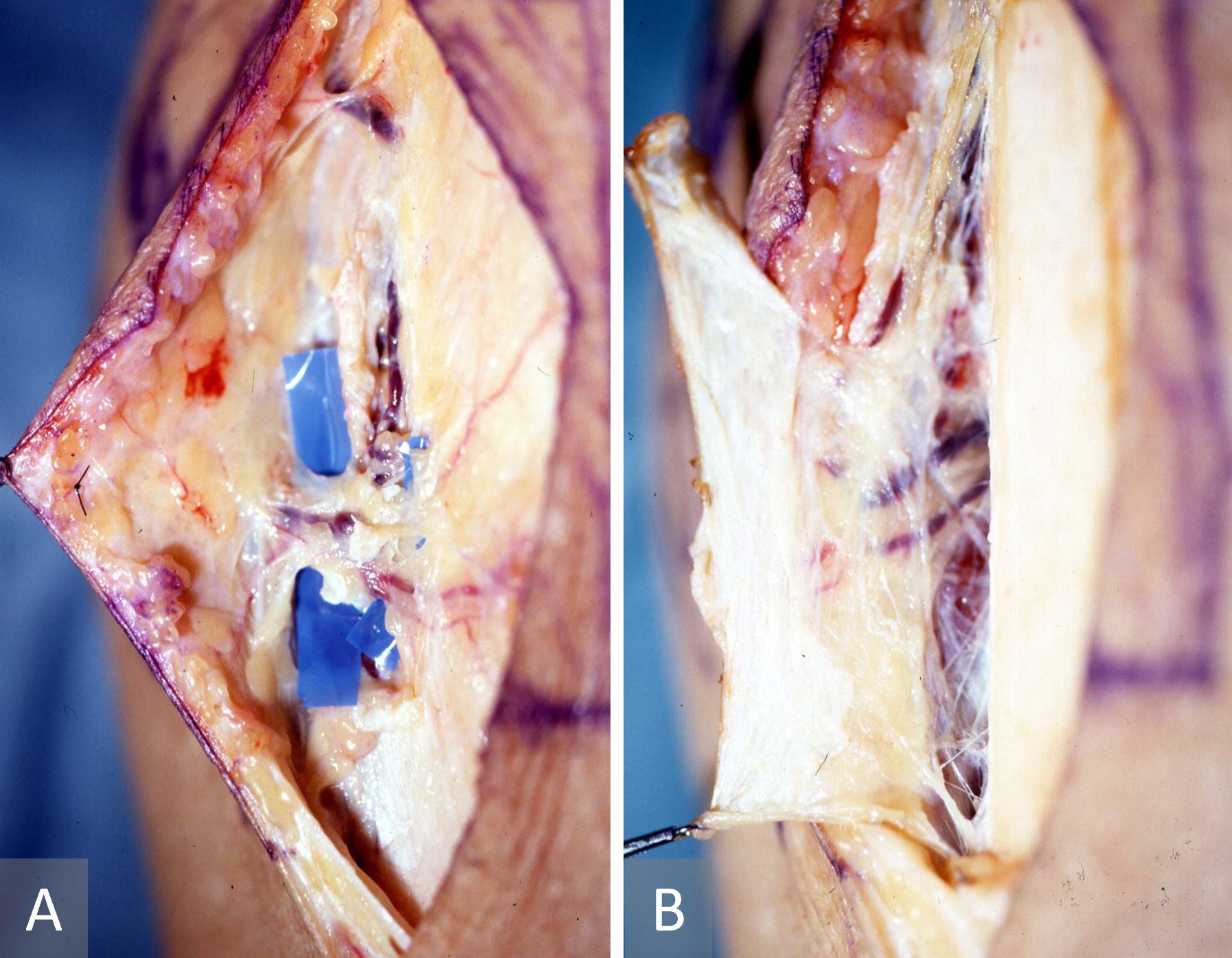 Figure 1.JPG